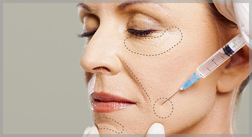 Infiltración de Labios Dr. Jesús Chung Zapopan